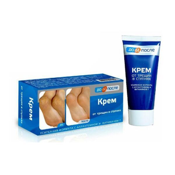 Kpem Tuýp 100ml